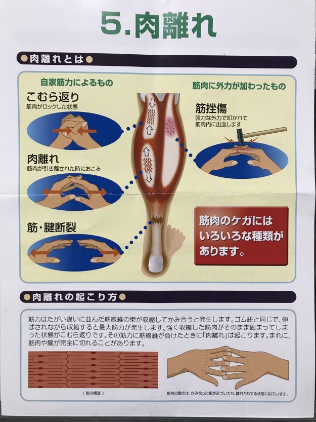 肉離れ 50代で初めての肉離れ 後編 家族のカタチ